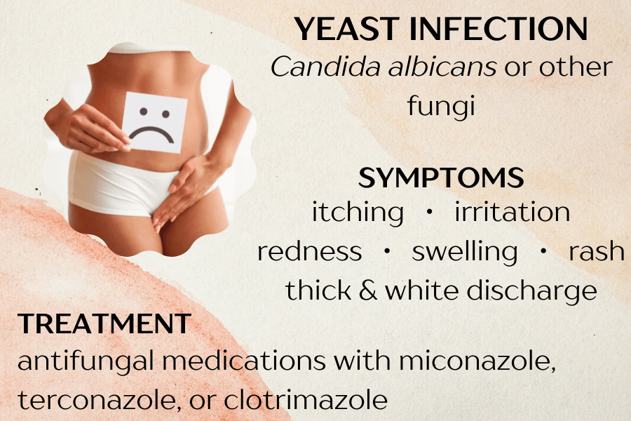Signs of a Yeast Infection During Pregnancy