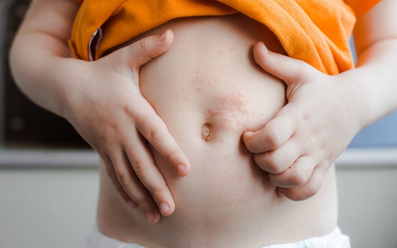 Tiny Colorless Itchy Bumps On Toddler Skin